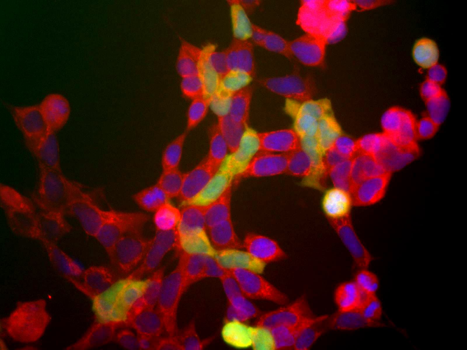 ENO2 / NSE Antibody