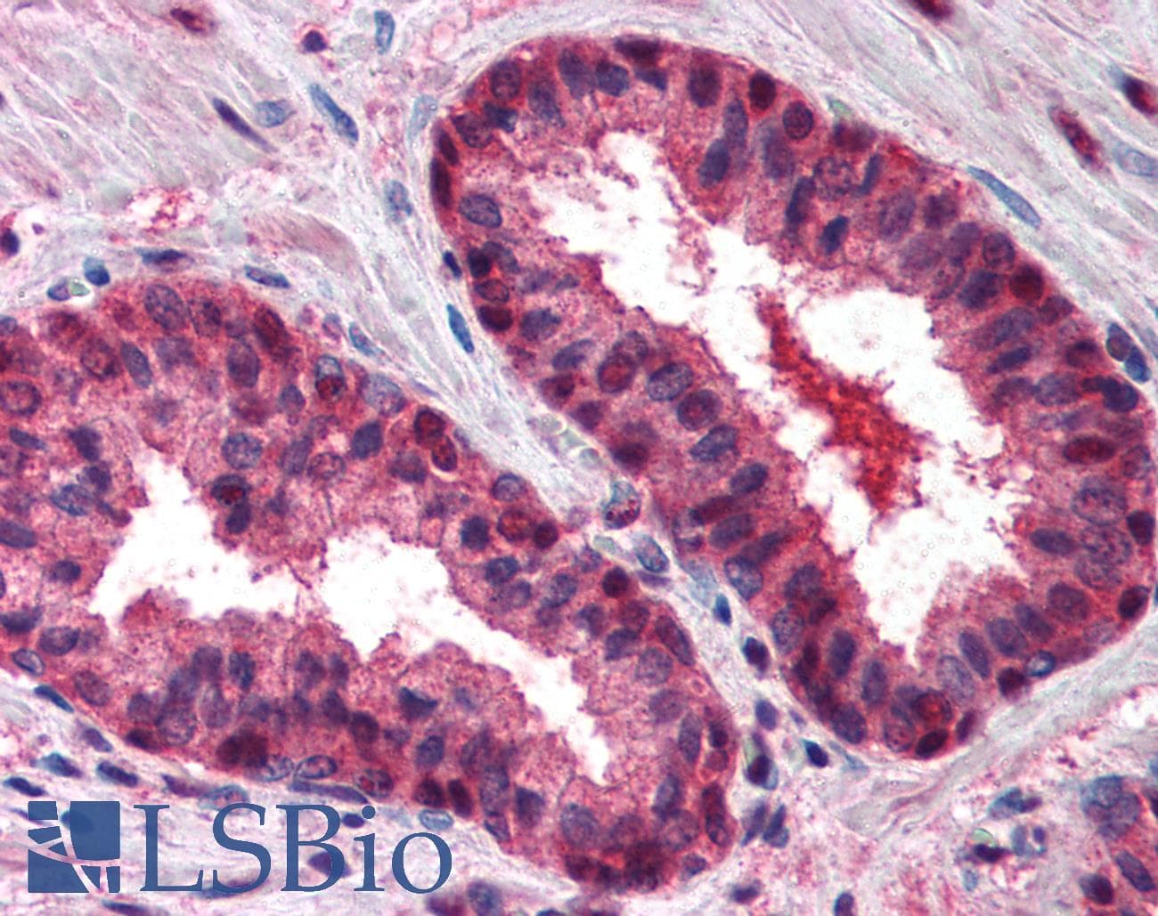 IHC-plus™ Polyclonal Rabbit anti-Human CUL2 / Cullin 2 Antibody (aa720-745, IHC, WB)