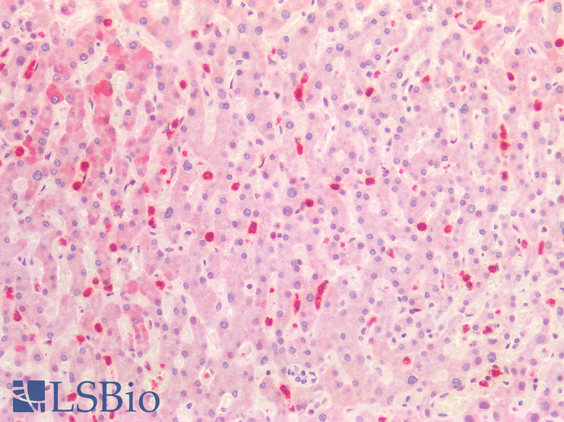 PathPlus™ HNE / Neutrophil Elastase Antibody