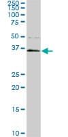 Monoclonal Mouse anti-Human PBK / TOPK Antibody (clone 3A7, IHC, IF, WB)