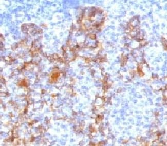 Acidic Cytokeratin Antibody (clone ACCK1-1)