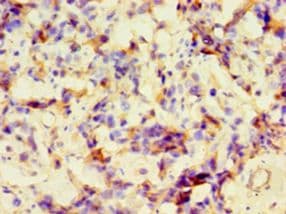 GRA1 / Dense granule protein 1 Antibody