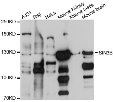 Polyclonal Rabbit anti-Human SIN3B Antibody (WB)