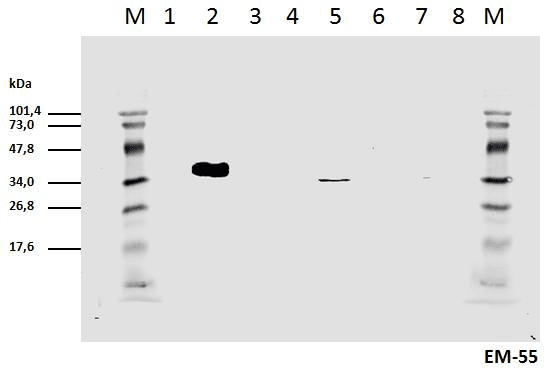 CD247 / CD3 Zeta Antibody (phospho-Tyr111, clone EM-55)