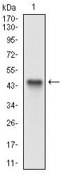 Monoclonal Mouse anti-Human ALCAM / CD166 Antibody (clone 8E12C7, aa48-216, IHC, IF, WB)