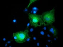 BIRC5 / Survivin Antibody (clone OTI3G3)