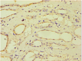 Polyclonal Rabbit anti-Human ATP5J Antibody (aa1-108, IHC)