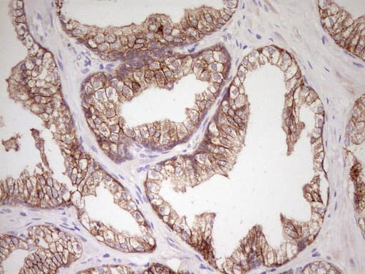 CDH1 / E Cadherin Antibody (clone UMAB184)