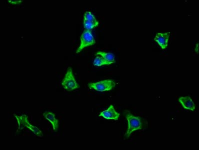 GPSM1 / AGS3 Antibody