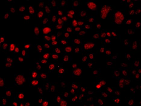 ARID1A / BAF250 Antibody
