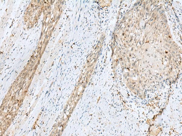 Polyclonal Rabbit anti-Human TEX11 Antibody (IHC)