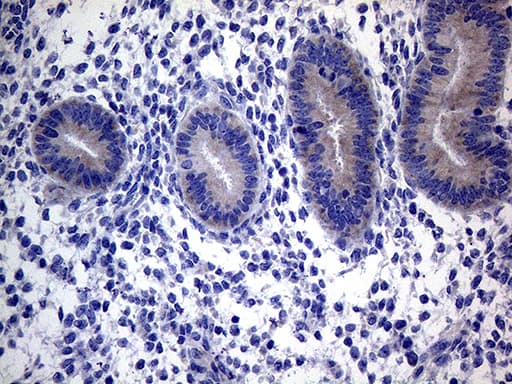 ACVR2 / ACVR2A Antibody (aa214-513, clone OTI1F2)