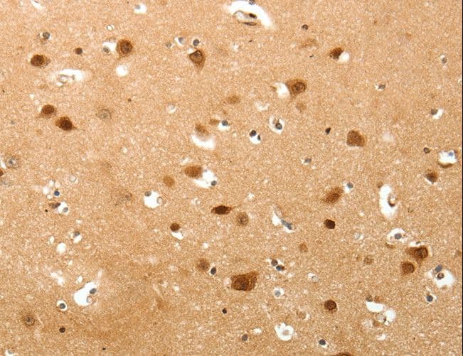 TNN / Tenascin N Antibody