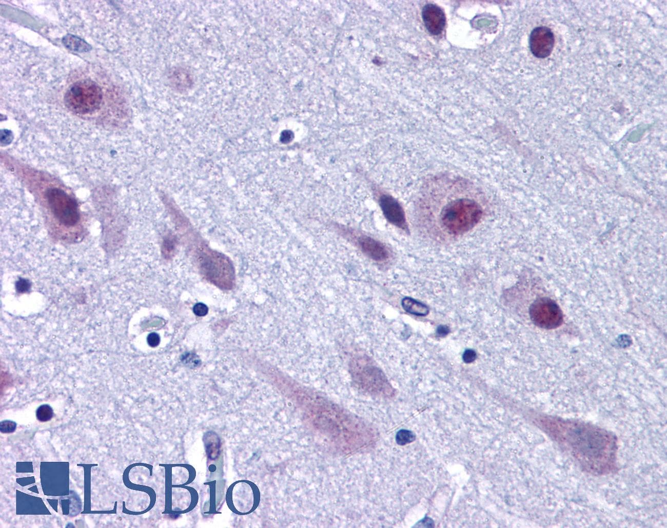 IHC-plus™ TDP-43 / TARDBP Antibody (C-Terminus)