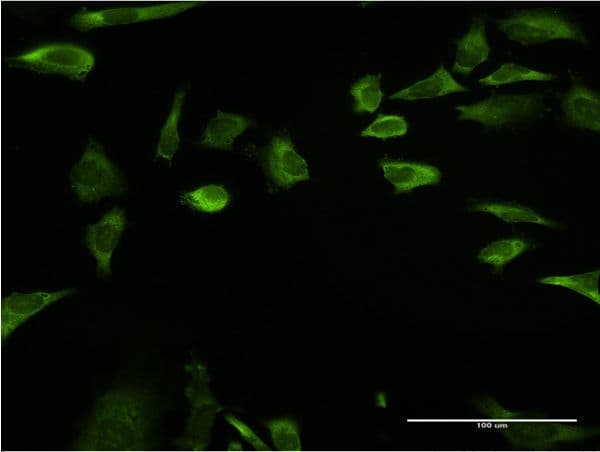Monoclonal Mouse anti-Human RPLP1 Antibody (clone 1G10, IF, WB)