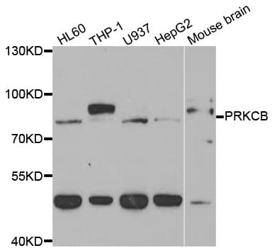 PRKCB / PKC-Beta Antibody