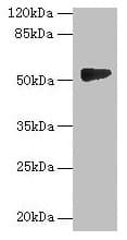 Polyclonal Rabbit anti-Human GTDC1 Antibody
