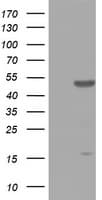 ZNF385B / ZNF533 Antibody (aa149-399, clone OTI1E3, Carrier-free)
