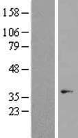 OR7C1 Protein (Over-Expression Lysate Myc-DDK (Flag))
