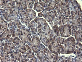 MAPK13 / p38delta Antibody (clone OTI12B2)
