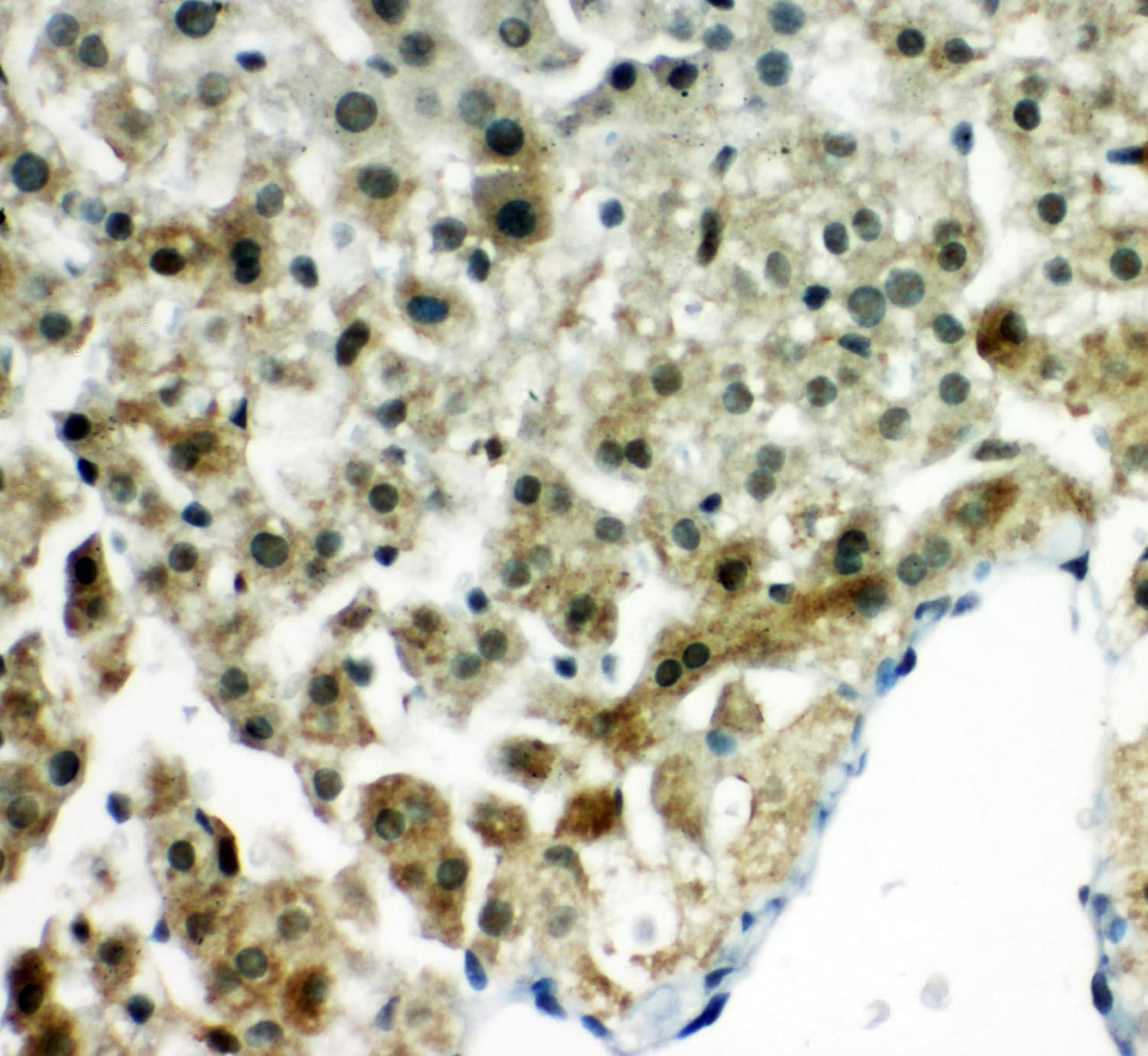 Polyclonal Rabbit anti-Human PRDX5 / Peroxiredoxin 5 Antibody (aa166-181, IHC, WB)