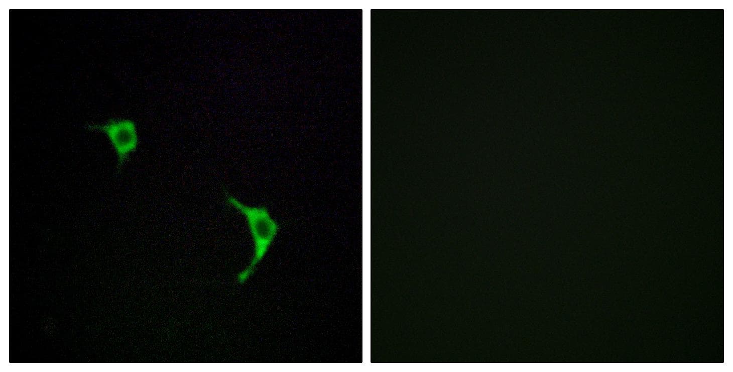 MAPK10 / JNK3 Antibody (p185)