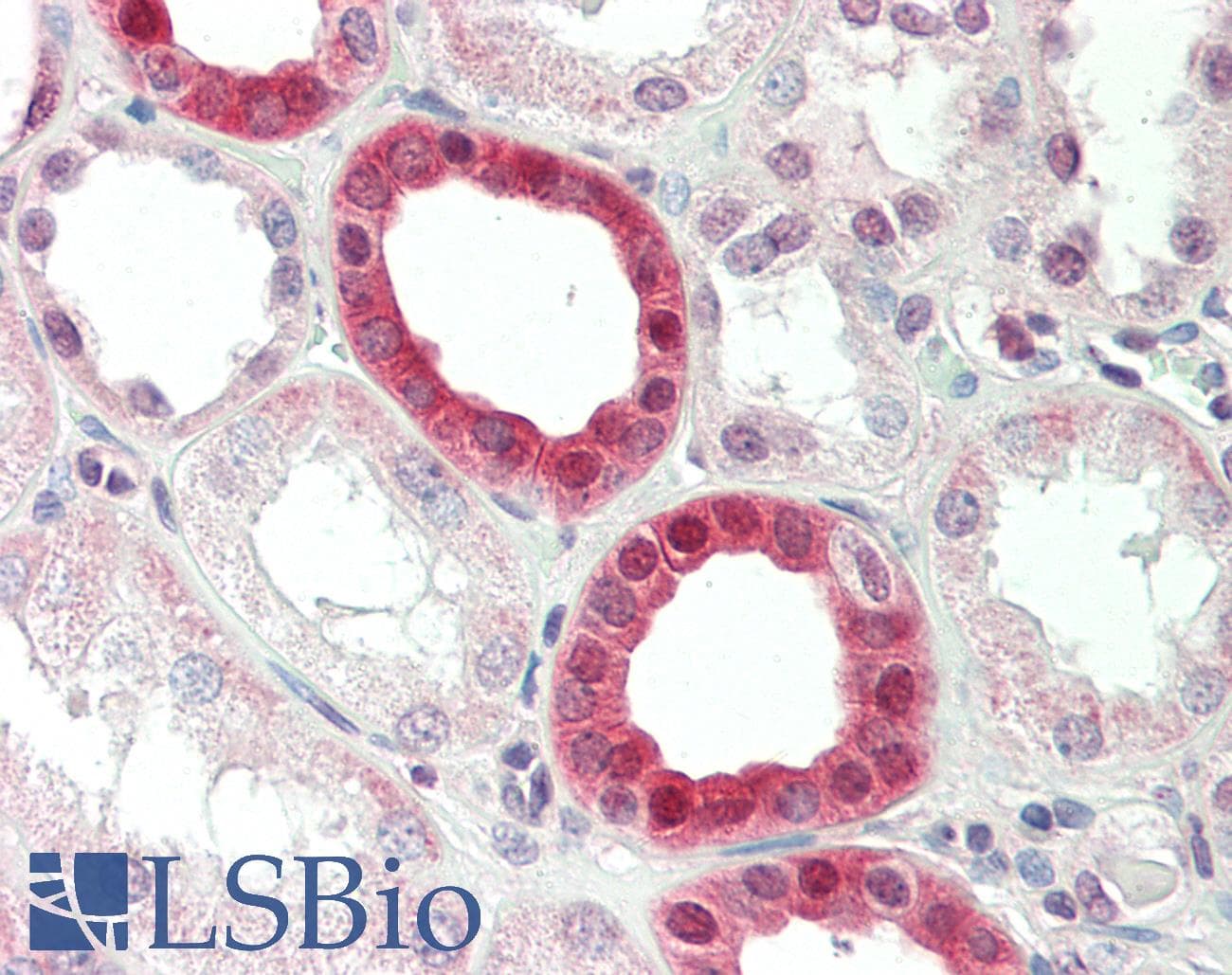 IHC-plus™ SYK Antibody (aa250-300)