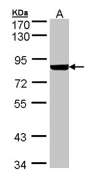 PFKL Antibody (aa428-674)