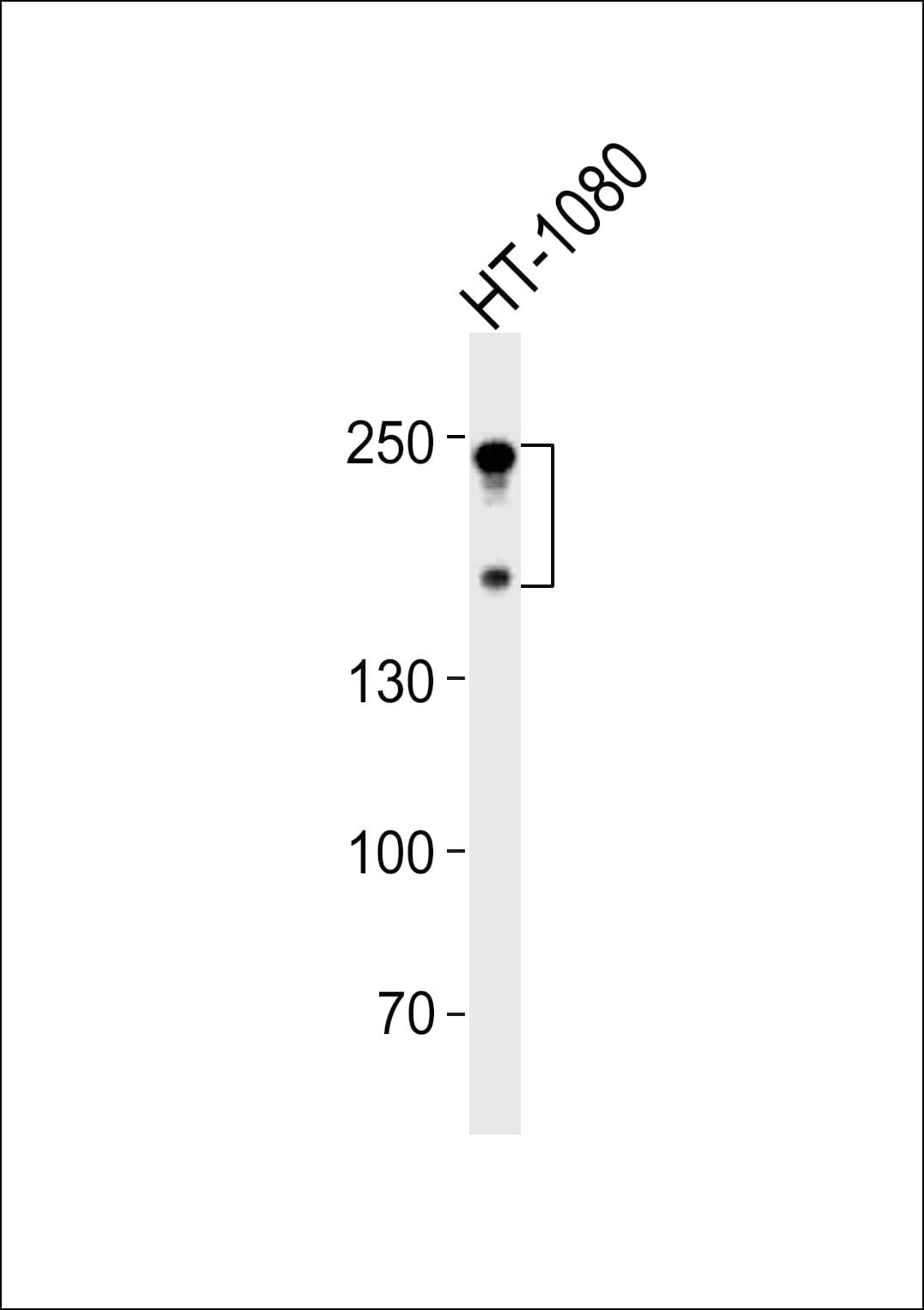 NCAM / CD56 Antibody (aa829-863)