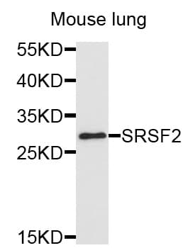 SRSF2 / SC35 Antibody
