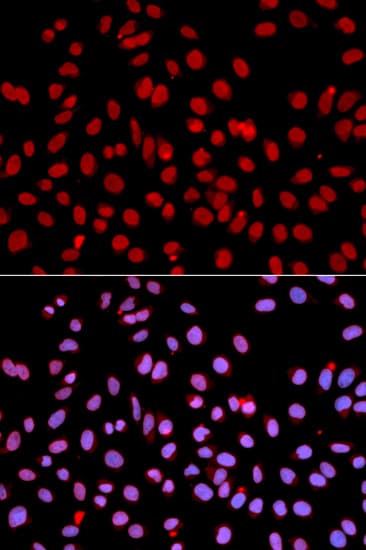POLR2J Antibody