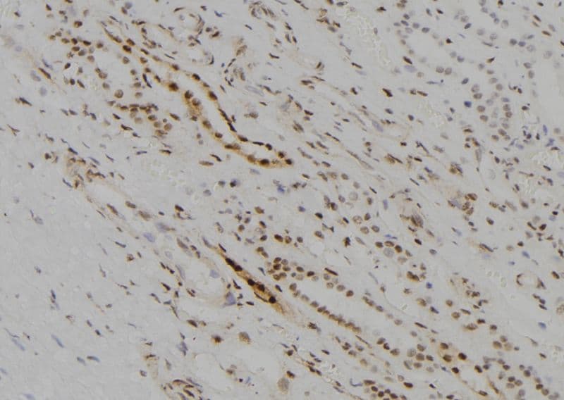 KDM5D / JARID1D Antibody