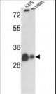 IHC-plus™ Polyclonal Rabbit anti-Human VDAC1 / PORIN Antibody (aa1-30, IHC, WB)