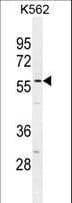 Polyclonal Rabbit anti-Human SMTNL1 Antibody (aa130-159, WB)