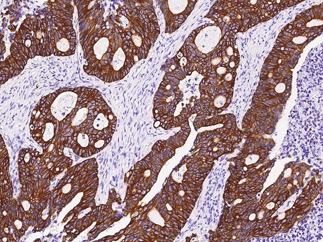Polyclonal Rabbit anti-Human KRT18 / CK18 / Cytokeratin 18 Antibody (Preservative Free, IHC, WB)