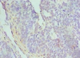 TGFBI Antibody (aa30-250)