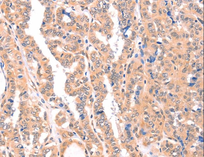 APBA2 Antibody