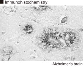 Monoclonal Mouse anti-Human APOE / Apolipoprotein E Antibody (clone 1F9, IHC, WB)