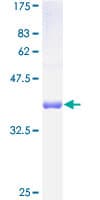 Human TIMM10B / FXC1 Protein (Recombinant GST)
