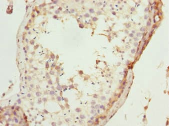 Polyclonal Rabbit anti-Human TAF11 Antibody (IHC)