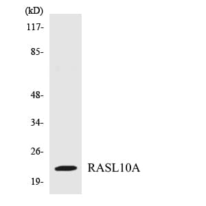 Polyclonal Rabbit anti-Human RRP22 / RASL10A Antibody (aa93-142, WB)