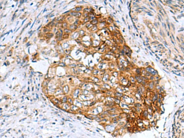 Polyclonal Rabbit anti-Human AP1S3 Antibody (IHC)