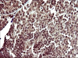 UPRT Antibody (clone OTI3A3, Carrier-free)