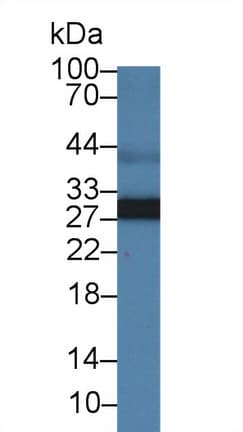 Adiponectin Antibody (aa18-244, Biotin)