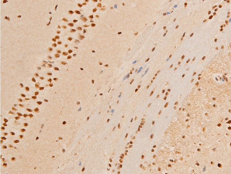 JUN / c-Jun Antibody (phospho-Thr93)