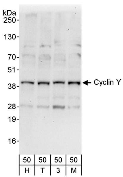 Polyclonal Rabbit anti-Human CCNY / Cyclin Y Antibody (aa291-341, WB)