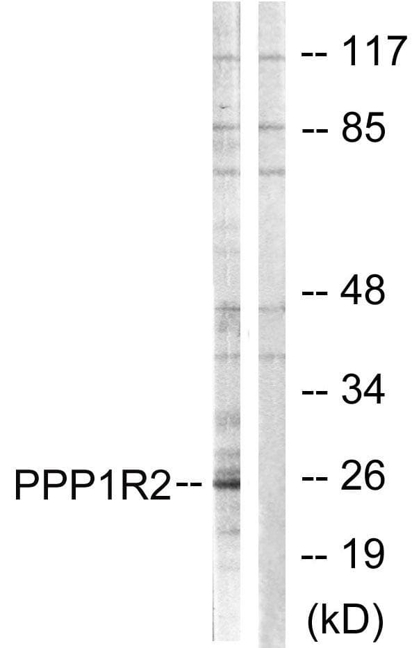 Polyclonal Rabbit anti-Human IPP2 / PPP1R2 Antibody (p120/121, IHC, WB)