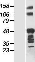 ANKRD40 Protein (Over-Expression Lysate Myc-DDK (Flag))