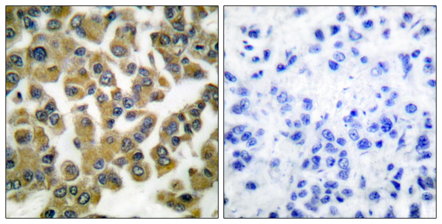 RPS6KB1 / P70S6K / S6K Antibody (p421/424)