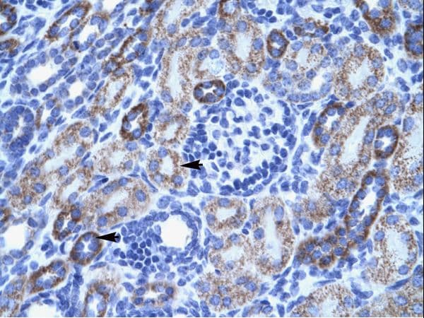 Polyclonal Rabbit anti-Human ACCN3 / ASIC3 Antibody (aa53-102, IHC, WB)